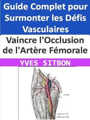 cover image of Vaincre l'Occlusion de l'Artère Fémorale